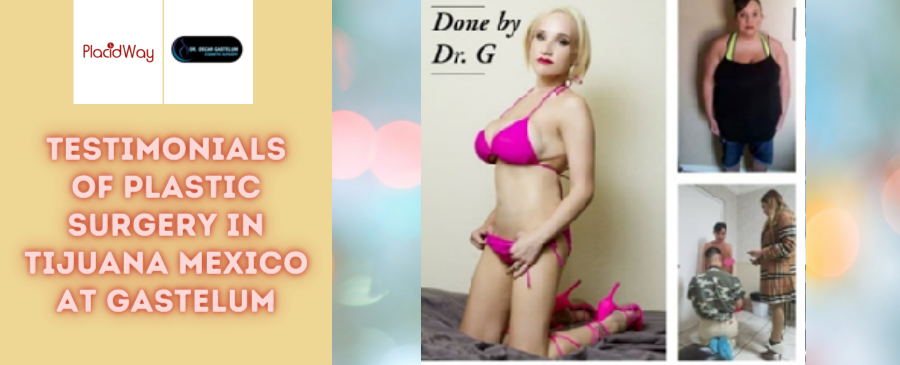 Testimonial of Cosmetic Surgery in Tijuana, Mexico