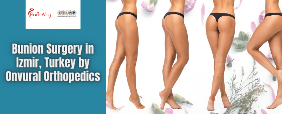 Cosmetic Foot Surgeries in Izmir, Turkey by Onvural Orthopedics