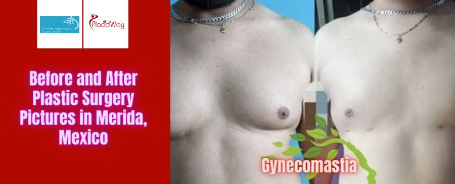 Dr. Ernesto Javier Acosta Abeyta Before and After