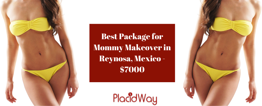 Mommy Makeover in Reynosa, Mexico