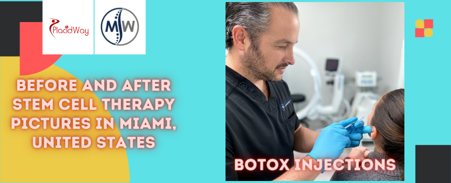 Before and After Stem Cell Therapy Pictures in Miami, United States
