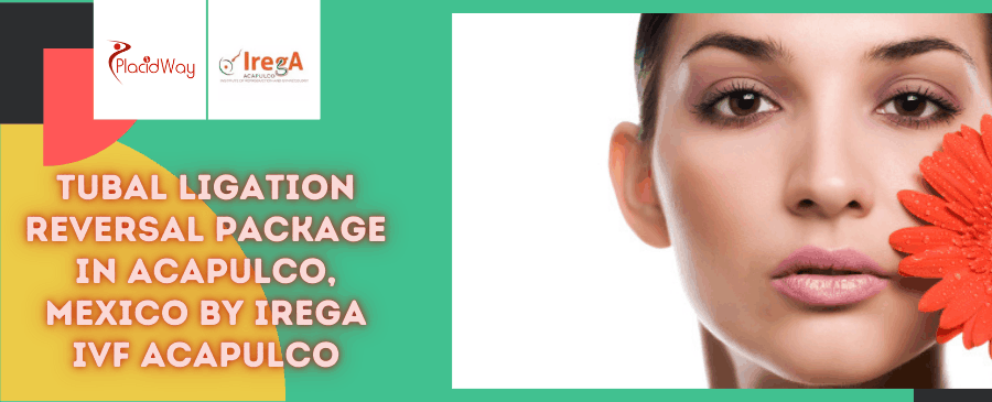Tubal Ligation Reversal Package in Acapulco, Mexico by IREGA IVF Acapulco