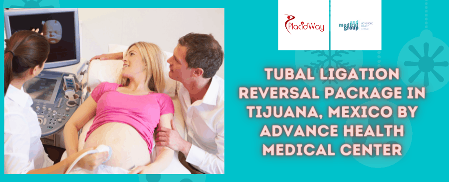 Tubal Ligation Reversal Package in Tijuana, Mexico by Advance Health Medical Center