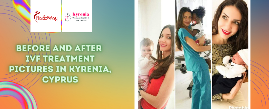 Before and After IVF Treatment in Kyrenia, Cyprus