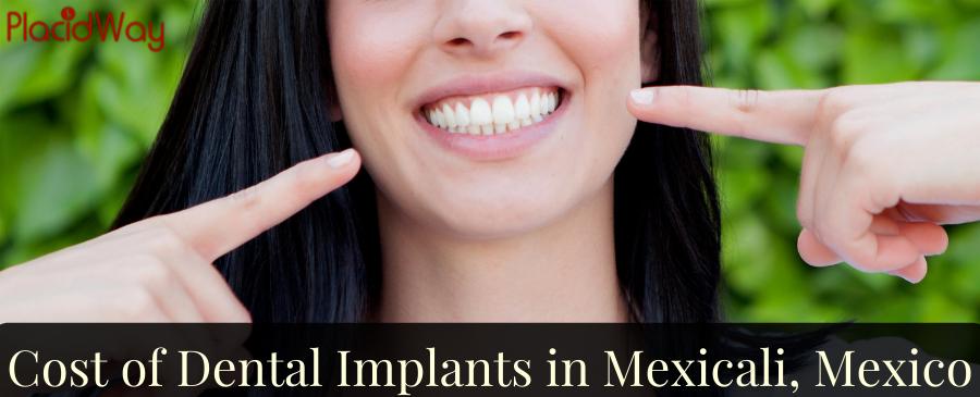 Cost of Dental Implants in Mexicali, Mexico