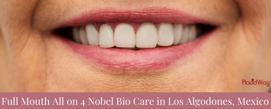 Full Mouth All-On-4 Nobel Bio Care in Los Algodones, Mexico