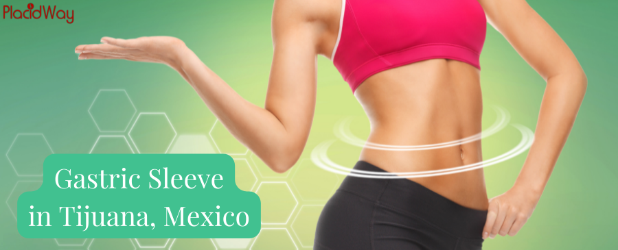 Gastric Sleeve in Tijuana, Mexico