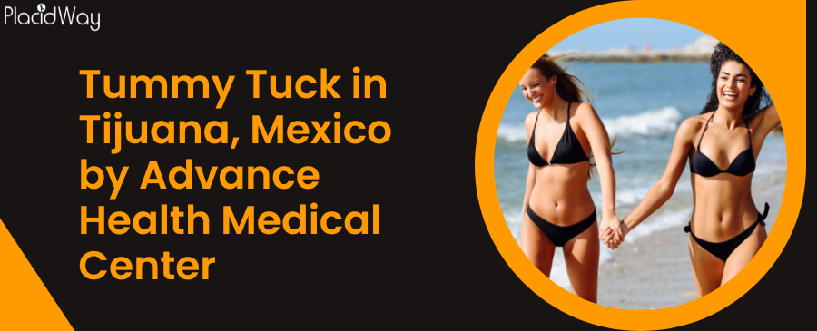 Tummy Tuck in Tijuana, Mexico
