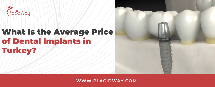 Dental Implants Cost in Turkey