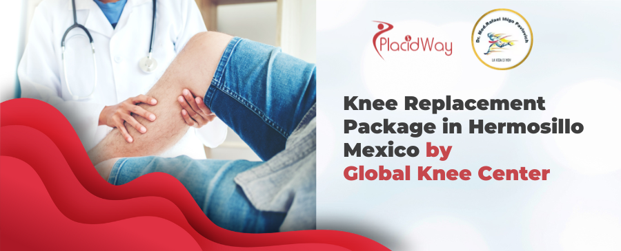 Knee Replacement Package in Hermosillo Mexico by Global Knee Center
