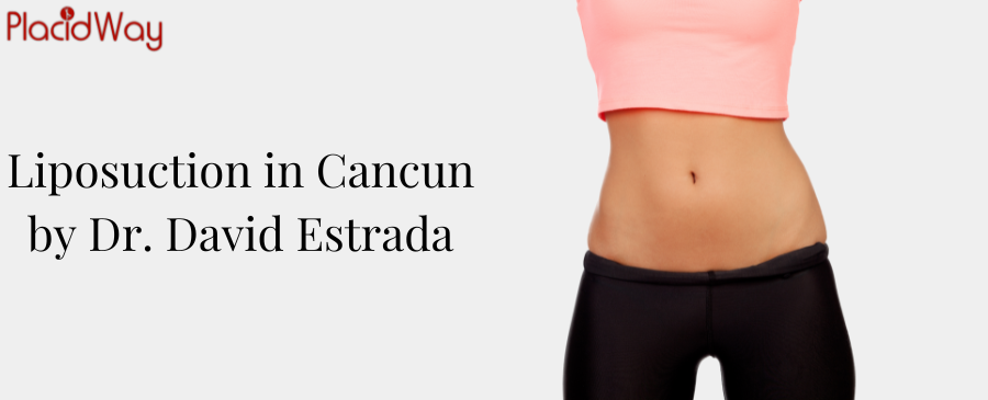 Liposuction in Cancun
