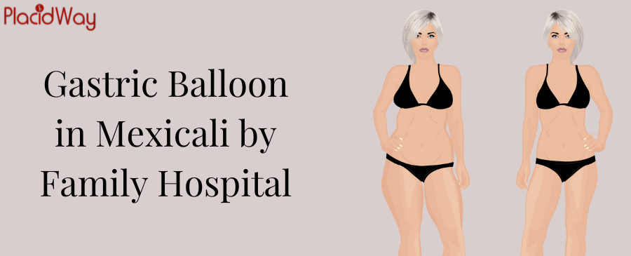 Gastric Balloon in Mexicali by Family Hospital