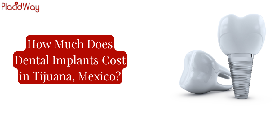Dental Implants Cost in Tijuana, Mexico