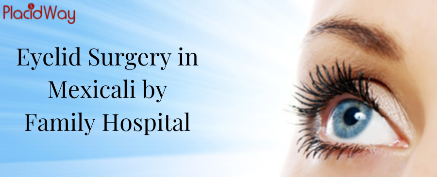 Eyelid Surgery in Mexicali by Family Hospital