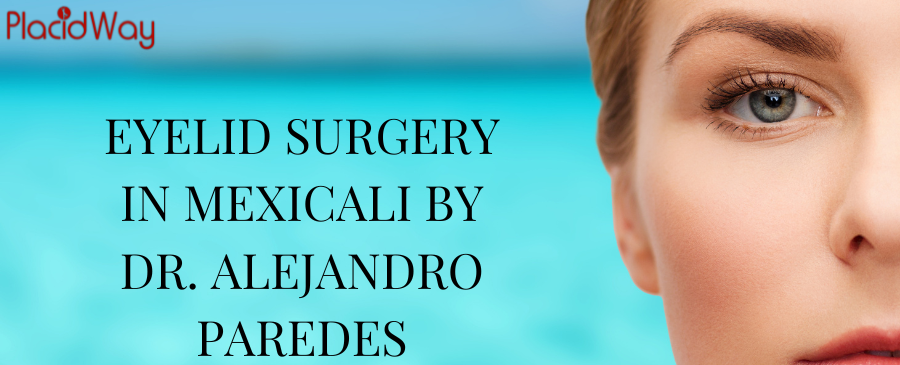 EYELID SURGERY IN MEXICALI BY DR. ALEJANDRO PAREDES