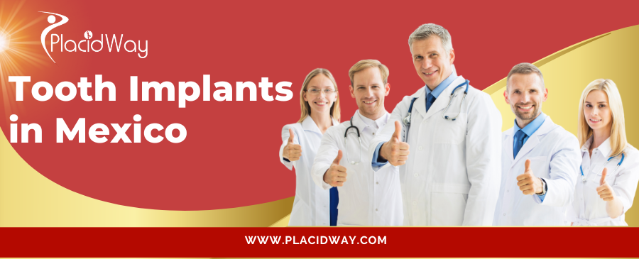Best Dental implants in Mexico