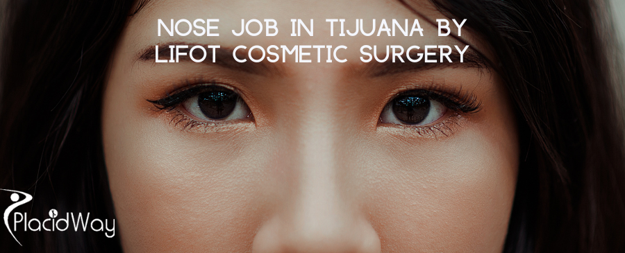 Nose Job in Tijuana by Lifot Cosmetic Surgery