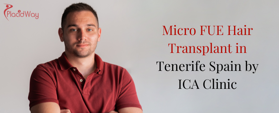 Micro FUE Hair Transplant in Tenerife Spain