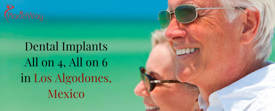 Dental Implants All on 4, All on 6 in Los Algodones, Mexico