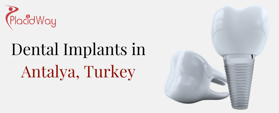 h Dental Implants in Antalya, Turkey