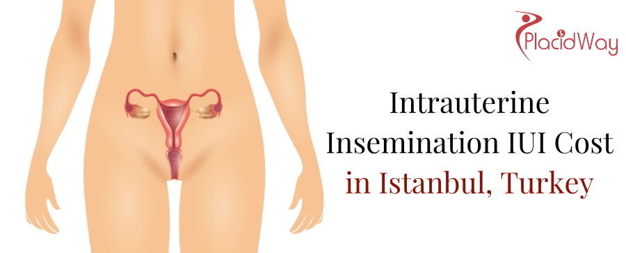 Intrauterine Insemination Cost in Istanbul, Turkey