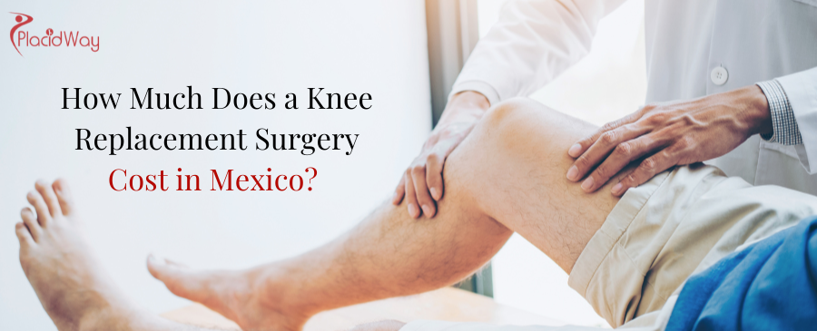 Knee Replacement Surgery Cost in Mexico