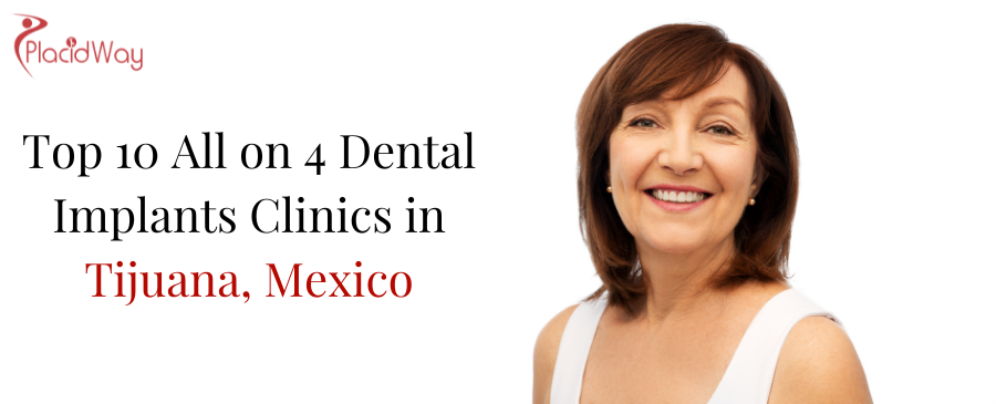 All on 4 Dental Implants Clinics in Tijuana, Mexico