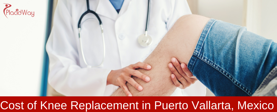 Cost of Knee Replacement in Puerto Vallarta, Mexico