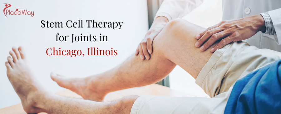 Stem Cell Therapy for Joints in Chicago, Illinois