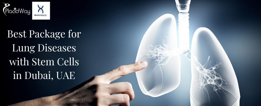 Best Package for Lung Diseases with Stem Cells in Dubai, UAE