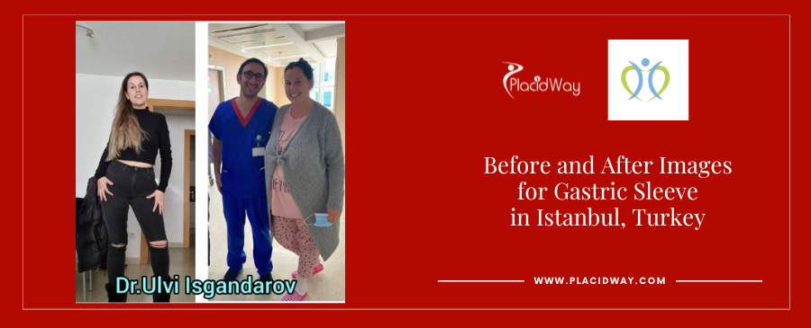 Obesity Weight Loss Surgery in Istanbul Turkey