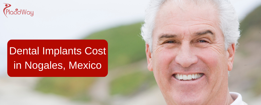 Dental Implants Cost in Nogales, Mexico