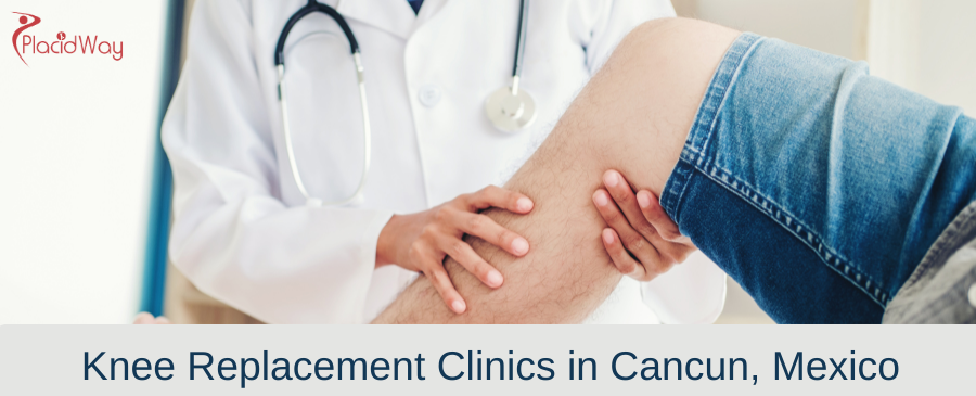 Knee Replacement Clinics in Cancun, Mexico