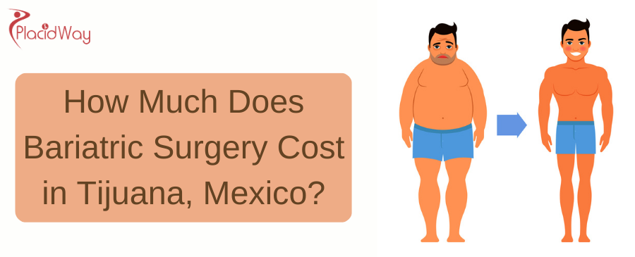 Bariatric Surgery Cost in Tijuana, Mexico