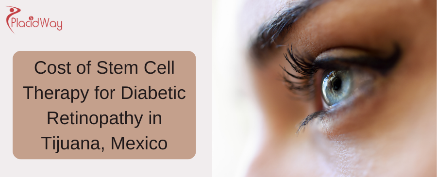Cost of Stem Cell Therapy for Diabetic Retinopathy in Tijuana, Mexico