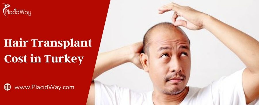 Hair Transplant Cost in Turkey