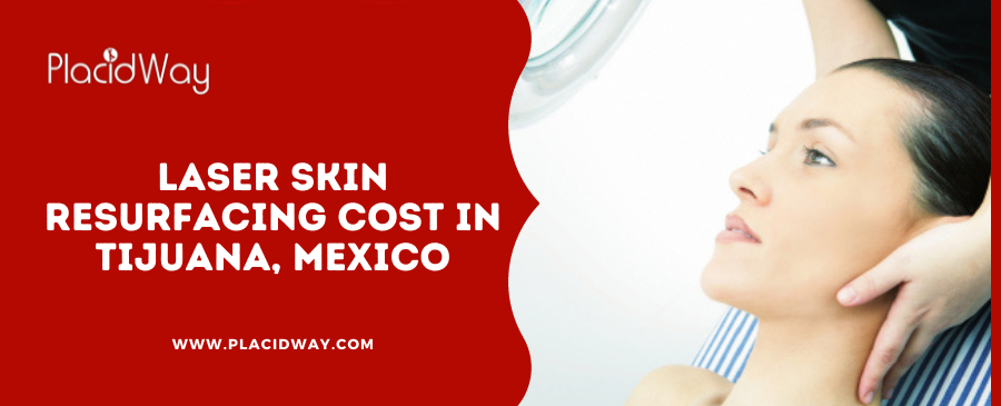 Laser Skin Resurfacing cost in Tijuana, Mexico