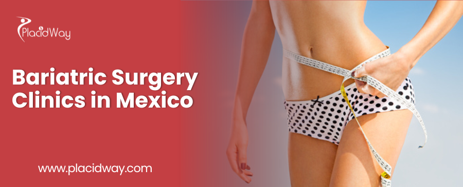 Bariatric Surgery Clinics in Mexico