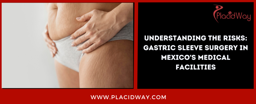 Understanding the Risks: Gastric Sleeve Surgery in Mexico's Medical Facilities