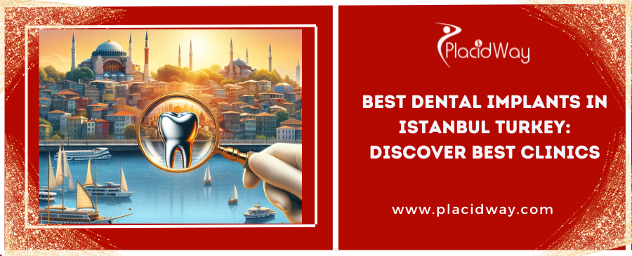 Best Dental Implants in Istanbul Turkey: Discover Best Clinics