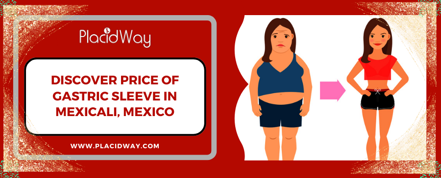 Gastric Sleeve in Mexicali, Mexico