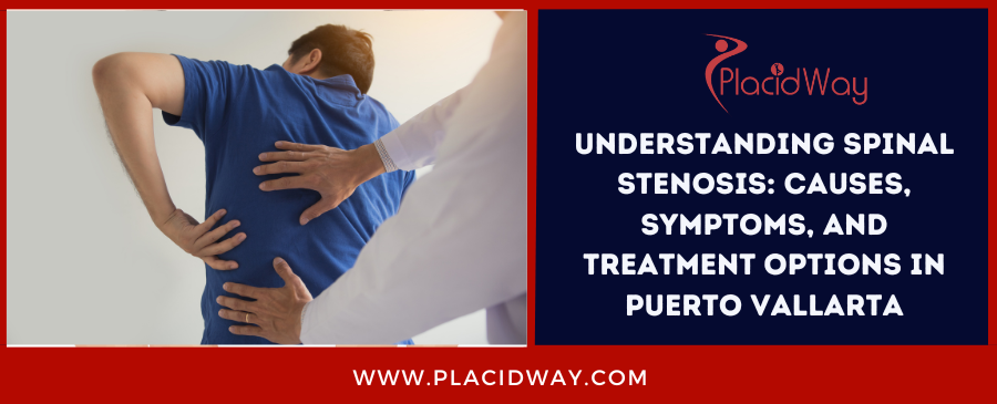 Understanding Spinal Stenosis: Causes, Symptoms, and Treatment Options in Puerto Vallarta