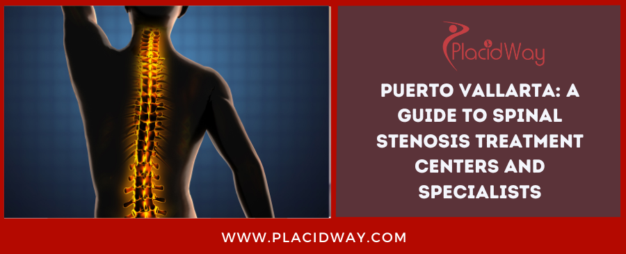 Puerto Vallarta: A Guide to Spinal Stenosis Treatment Centers and Specialists