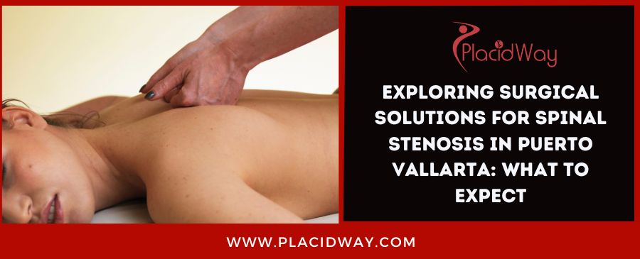 Exploring Surgical Solutions for Spinal Stenosis in Puerto Vallarta: What to Expect