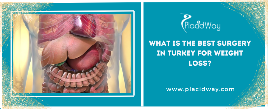 What is the Best Surgery in Turkey for Weight Loss?