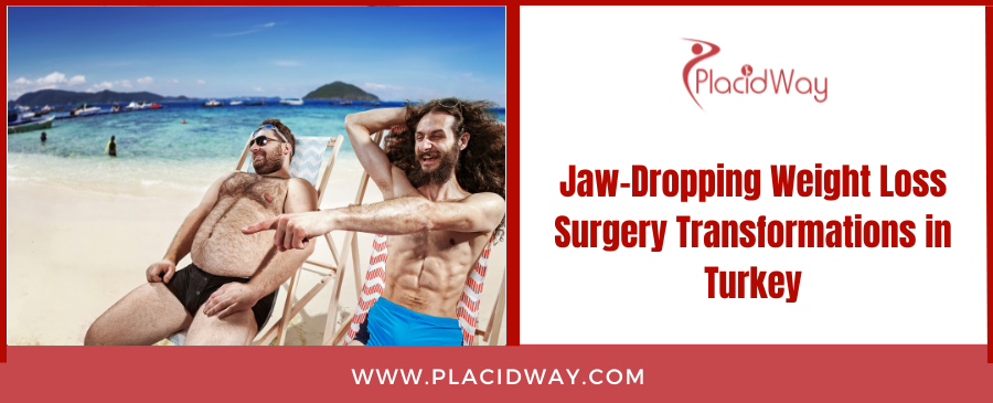 Jaw-Dropping Weight Loss Surgery Transformations in Turkey