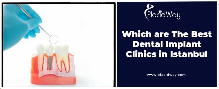 Which are The Best Dental Implant Clinics in Istanbul