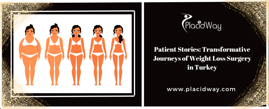 Patient Stories: Transformative Journeys of Weight Loss Surgery in Turkey