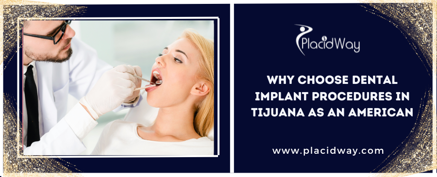 Why Choose Dental Implant Procedures in Tijuana as an American