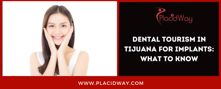 Dental Tourism in Tijuana For Implants: What to know